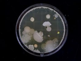 Cultura de Bactérias: Universidade de Coimbra apresenta coleção para assinalar Dia Internacional do Microrganismo cultura de bacterias