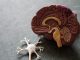 Doença de Alzheimer: investigadores exploram possível ferramenta inovadora na terapia doenca de alzheimer