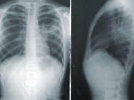 Técnicos Superiores de Diagnóstico e Terapêutica preocupados com a evolução da pandemia evolução da pandemia