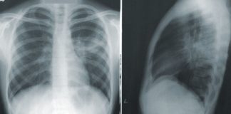Técnicos Superiores de Diagnóstico e Terapêutica preocupados com a evolução da pandemia evolução da pandemia