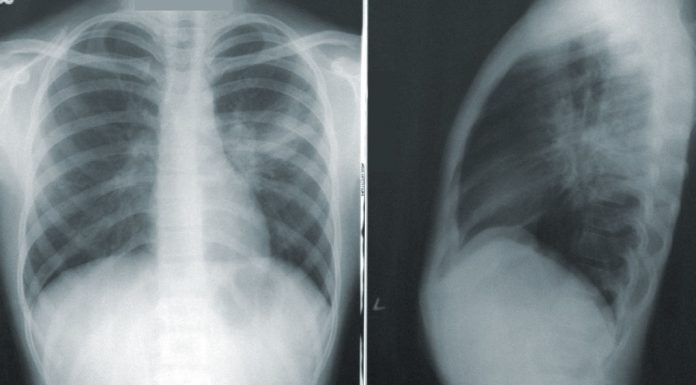 Técnicos Superiores de Diagnóstico e Terapêutica preocupados com a evolução da pandemia evolução da pandemia