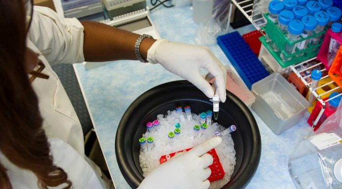 Técnicos de análises clínicas temem que não hajam testes de diagnóstico suficientes para o Covid-19 no SNS técnico de análises clínicas