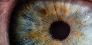Hemi-prosopometamorfopsia: estudo com homem que vê caras a “derreter” permite perceber como o nosso cérebro reconhece faces hemi-prosopometamorfopsia