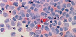 Luta contra o cancro: Startup portuguesa vence prémio internacional luta contra o cancro