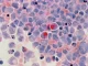 Luta contra o cancro: Startup portuguesa vence prémio internacional luta contra o cancro