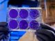 Alternativa aos antibióticos: cientistas criam “mutante” para combater bactérias multirresistentes alternativa antibioticos