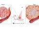 Molécula inovadora para tratamento do cancro em desenvolvimento na Universidade de Coimbra molecula inovadora